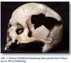 Ledokoin von der Hämorrhoide